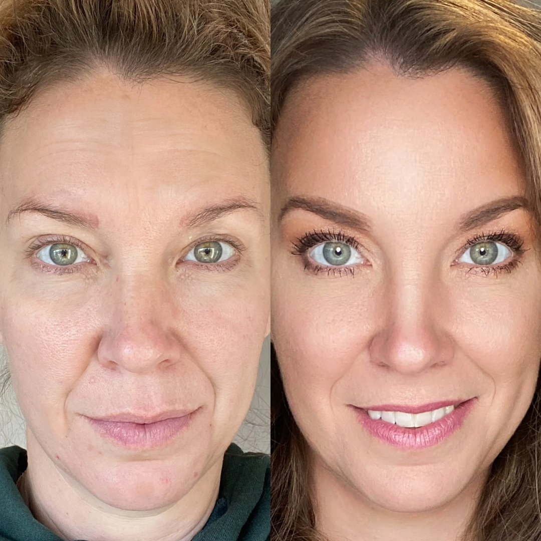 RevitaRay LumiSculpt™ Multispectral Light & EMS Facial Device