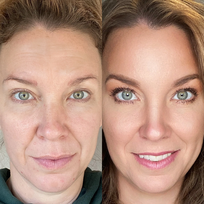 RevitaRay LumiSculpt™ Multispectral Light & EMS Facial Device