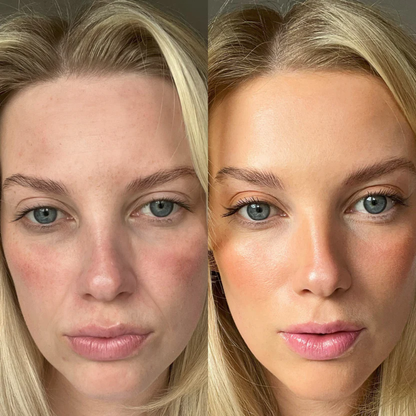 RevitaRay LumiSculpt™ Multispectral Light & EMS Facial Device
