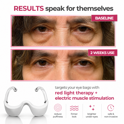 RevitaRay LumiLift™ Eye Therapy Device